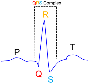 Diagram of Q, R, and S points create the QRS complex